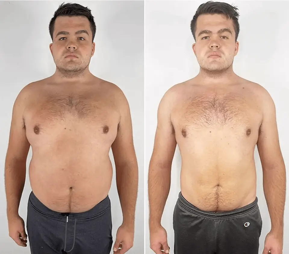 Michael Chumikhin transformation